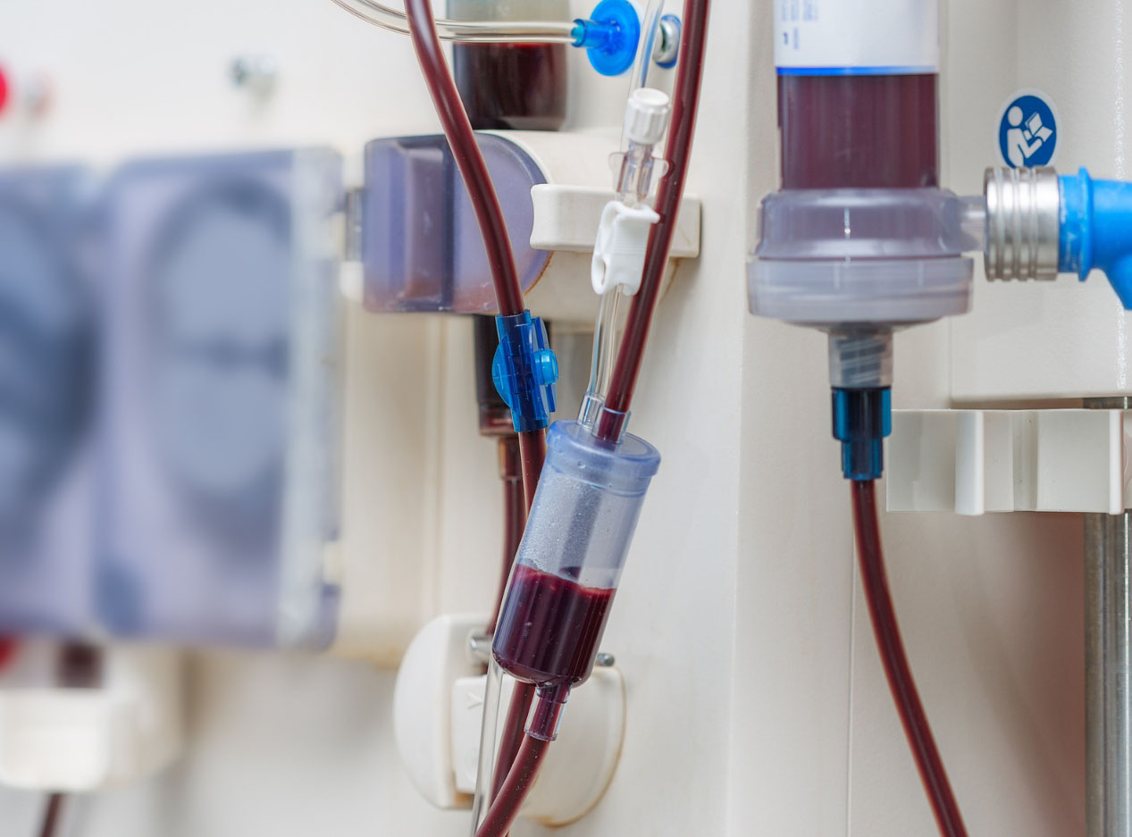 2025102219156051.jpg 血液透析.jpg